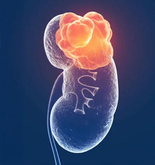 Urología Oncológica