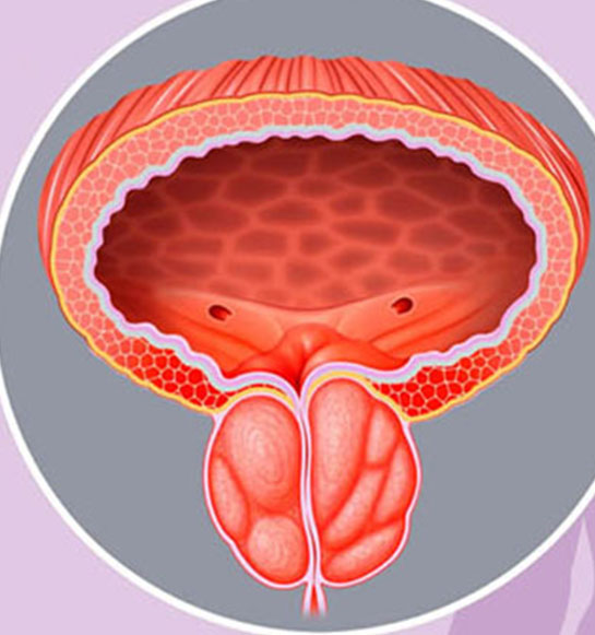 Crecimiento Prostático