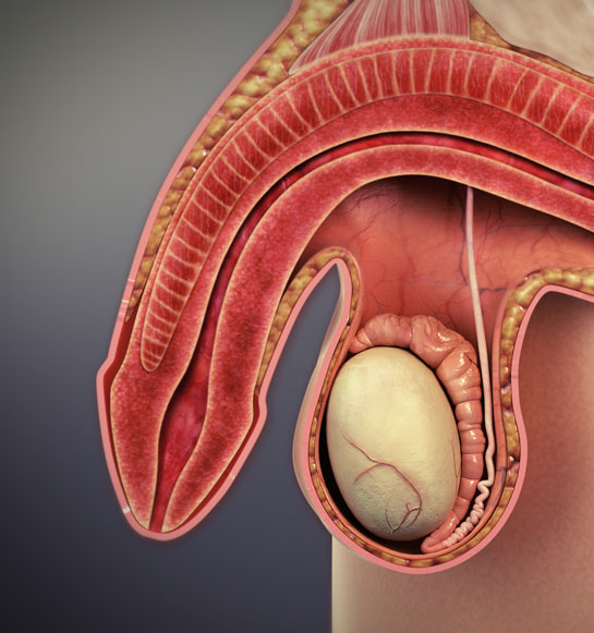 Disfunción Eréctil